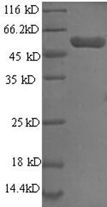 Greater than 90% as determined by SDS-PAGE.Recombinant Human D-3-Phosphoglycerate Dehydrogenase (PHGDH) Protein (GST)