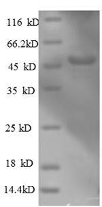 Greater than 90% as determined by SDS-PAGE.Recombinant Human Actin-Related Protein 2/3 Complex Subunit 3 (ARPC3) Protein (GST)