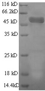 Greater than 90% as determined by SDS-PAGE.Recombinant Human Actin-Related Protein 2/3 Complex Subunit 2 (ARPC2) Protein (GST)