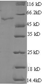 Greater than 90% as determined by SDS-PAGE.Recombinant Human Star-Related Lipid Transfer Protein 7, Mitochondrial (STARD7) Protein (GST)