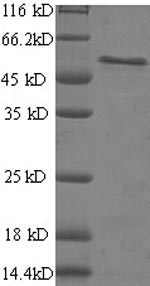 Greater than 90% as determined by SDS-PAGE.Recombinant Human B-Cell Receptor-Associated Protein 31 (BCAP31) Protein (GST)
