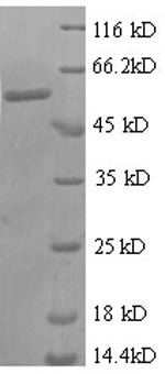 Greater than 90% as determined by SDS-PAGE.Recombinant Human Zinc Finger Protein 384 (ZNF384) Protein (GST)