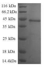 Greater than 90% as determined by SDS-PAGE.Recombinant Human Nuclear Nucleic Acid-Binding Protein C1D (C1D) Protein (GST)