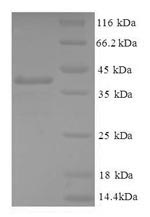 Greater than 90% as determined by SDS-PAGE.Recombinant Human Gamma-Aminobutyric Acid Receptor-Associated Protein-Like 2 (GABARAPL2) Protein (GST)