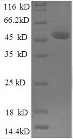 Greater than 90% as determined by SDS-PAGE.Recombinant Human Ubiquitin Thioesterase Otub1 (OTUB1) Protein (GST)