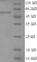 Greater than 90% as determined by SDS-PAGE.Recombinant Human Heat Shock Protein 75 Kda, Mitochondrial (TRAP1) Protein (GST)