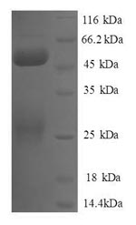 Greater than 90% as determined by SDS-PAGE.Recombinant Human Negative Elongation Factor B (NELFB) Protein (GST)