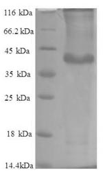 Greater than 90% as determined by SDS-PAGE.Recombinant Human Protein Phosphatase 1 Regulatory Subunit 11 (PPP1R11) Protein (GST)