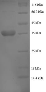 Greater than 90% as determined by SDS-PAGE.Recombinant Human Cytochrome B-C1 Complex Subunit 8 (UQCRQ) Protein (GST)
