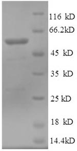Greater than 90% as determined by SDS-PAGE.Recombinant Human Tubulin Beta-3 Chain (TUBB3) Protein (GST)