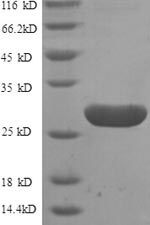 Greater than 90% as determined by SDS-PAGE.Recombinant Human G-Protein Coupled Receptor 161 (GPR161) Protein (GST)