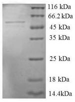 Greater than 90% as determined by SDS-PAGE.Recombinant Human Seryl-Trna Synthetase,Cytoplasmic Domain Protein (SARS) Protein (GST)