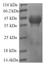 Greater than 90% as determined by SDS-PAGE.Recombinant Human 60S Ribosomal Protein L35 (RPL35) Protein (GST)