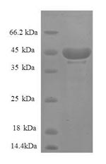 Greater than 90% as determined by SDS-PAGE.Recombinant Human 40S Ribosomal Protein S14 (RPS14) Protein (GST)