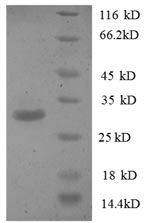 Greater than 90% as determined by SDS-PAGE.Recombinant Human Phosphatidylserine Synthase 1 (PTDSS1) Protein (GST)