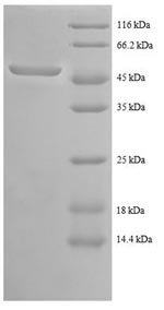 Greater than 90% as determined by SDS-PAGE.Recombinant Human Tyrosine-Protein Kinase Abl1 (ABL1) Protein (GST)