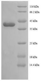 Greater than 90% as determined by SDS-PAGE.Recombinant Human Tax1-Binding Protein 3 (TAX1BP3) Protein (GST)