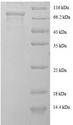 Greater than 90% as determined by SDS-PAGE.Recombinant Human Ef-Hand Domain-Containing Protein Kiaa0494 (EFCAB14) Protein (GST)