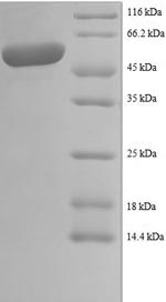 Greater than 90% as determined by SDS-PAGE.Recombinant Human Lim And Sh3 Domain Protein 1 (LASP1) Protein (GST)