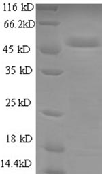 Greater than 90% as determined by SDS-PAGE.Recombinant Human Cytochrome B-C1 Complex Subunit Rieske, Mitochondrial (UQCRFS1) Protein (GST)