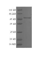Greater than 90% as determined by SDS-PAGE.Recombinant Human Breast Cancer Metastasis-Suppressor 1 (BRMS1) Protein (GST)