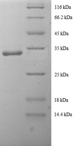 Greater than 90% as determined by SDS-PAGE.Recombinant Human Tricarboxylate Transport Protein (SLC25A1) Protein (GST)