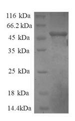 Greater than 90% as determined by SDS-PAGE.Recombinant Human Comm Domain-Containing Protein 4 (COMMD4) Protein (GST)