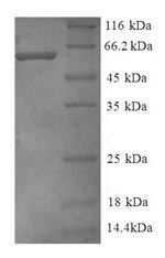 Greater than 90% as determined by SDS-PAGE.Recombinant Human Guanine nucleotide-binding protein G (GNB2) Protein (GST)