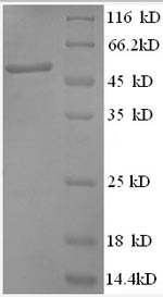 Greater than 90% as determined by SDS-PAGE.Recombinant Human Anaphase-Promoting Complex Subunit 5 (ANAPC5) Protein (GST)