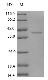 Greater than 90% as determined by SDS-PAGE.Recombinant Human Eukaryotic Translation Initiation Factor 1 (EIF1) Protein (GST)
