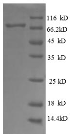 Greater than 90% as determined by SDS-PAGE.Recombinant Human Dolichyl-Diphosphooligosaccharide--Protein Glycosyltransferase 48 Kda Subunit (RPN1) Protein (GST)