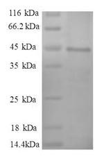 Greater than 90% as determined by SDS-PAGE.Recombinant Human Myosin Light Polypeptide 6 (MYL6) Protein (GST)