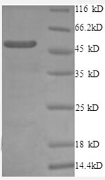 Greater than 90% as determined by SDS-PAGE.Recombinant Human 60S Ribosomal Protein L10A (RPL10A) Protein (GST)