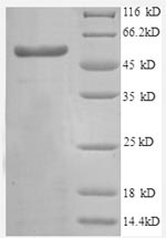 Greater than 90% as determined by SDS-PAGE.Recombinant Human Transcription Intermediary Factor 1-Beta (TRIM28) Protein (GST)