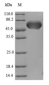 Greater than 90% as determined by SDS-PAGE.Recombinant Human Protein Aatf (AATF) Protein (GST)