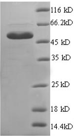 Greater than 90% as determined by SDS-PAGE.Recombinant Human Endoplasmic Reticulum Resident Protein 29 (ERP29) Protein (GST)