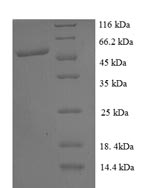 Greater than 90% as determined by SDS-PAGE.Recombinant Human Prkca-Binding Protein (PICK1) Protein (GST)