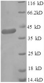 Greater than 90% as determined by SDS-PAGE.Recombinant Human Gamma-Aminobutyric Acid Receptor-Associated Protein (GABARAP) Protein (GST)