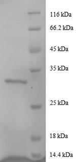 Greater than 90% as determined by SDS-PAGE.Recombinant Human Agouti-Related Protein (AGRP) Protein (GST)