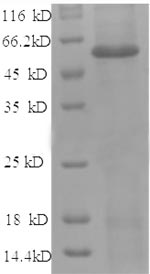 Greater than 90% as determined by SDS-PAGE.Recombinant Human Angiopoietin-2 (ANGPT2) Protein (His)