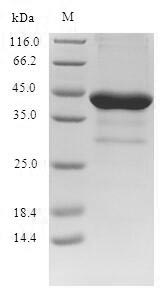 Greater than 90% as determined by SDS-PAGE.Recombinant Human Brain-Derived Neurotrophic Factor (BDNF) Protein (GST)