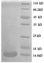 Greater than 90% as determined by SDS-PAGE.Recombinant Human C-C Motif Chemokine 24 (CCL24) Protein (His)