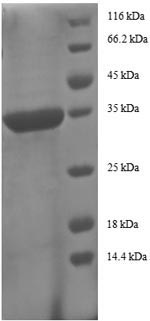 Greater than 90% as determined by SDS-PAGE.Recombinant Human C-C Motif Chemokine 5 (CCL5) Protein (GST)