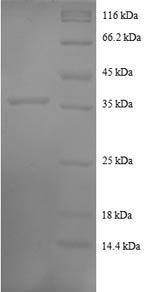 Greater than 90% as determined by SDS-PAGE.Recombinant Human C-C Motif Chemokine 7 (CCL7) Protein (GST)