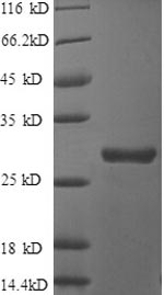 Greater than 90% as determined by SDS-PAGE.Recombinant Human Clusterin (CLU) Protein (His)