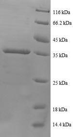 Greater than 90% as determined by SDS-PAGE.Recombinant Human C-X-C Motif Chemokine 5 (CXCL5) Protein (GST)