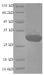 Greater than 90% as determined by SDS-PAGE.Recombinant Human Endothelin-1 (EDN1) Protein (GST), Active