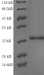 Greater than 90% as determined by SDS-PAGE.Recombinant Human Endothelial Protein C Receptor (PROCR) Protein (His)