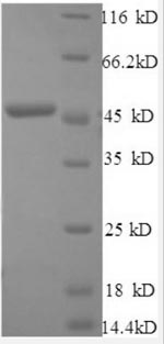 Greater than 90% as determined by SDS-PAGE.Recombinant Human Interferon Beta Protein (IFNB1) Protein (GST)