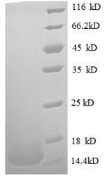 Greater than 90% as determined by SDS-PAGE.Recombinant Human Macrophage Migration Inhibitory Factor (MIF) Protein (His)